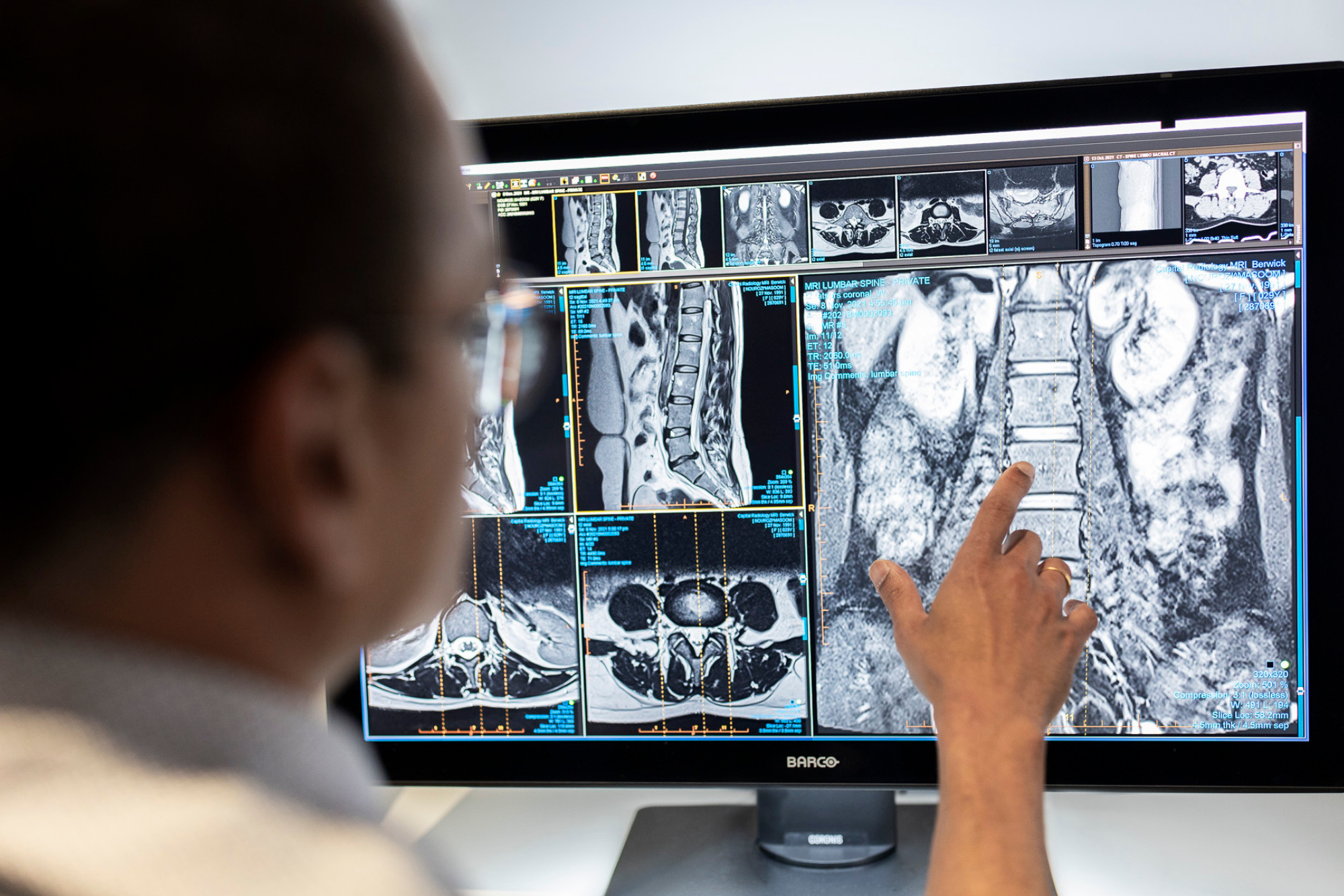 Male Doctor Studying Patient's Spinal Cord X ray | Medical Imaging Center | Capital Radiology